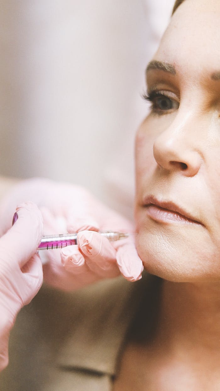 Close-up of a woman receiving a dermal filler injection, highlighting modern beauty treatments.